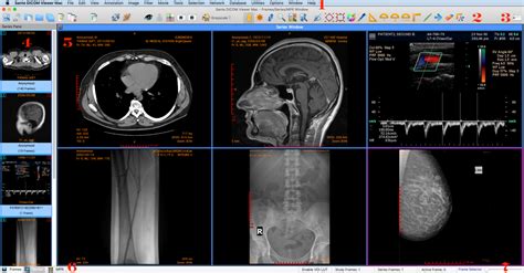 dicom image viewer.